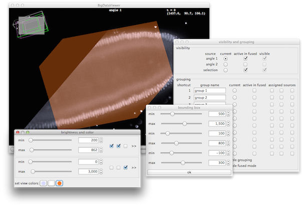 BigDataViewer screenshot