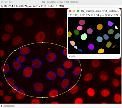 /media/cellpose-appose/process_roi.png