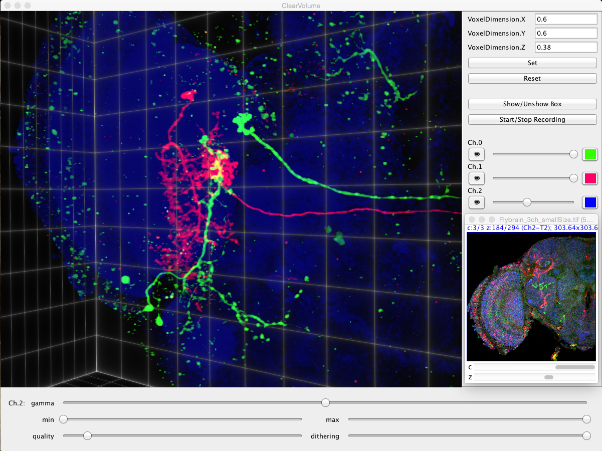 ClearVolume in Fiji screenshot