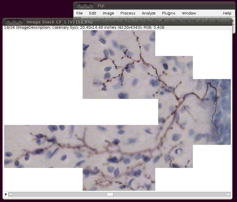 diadem-cerebellar-2