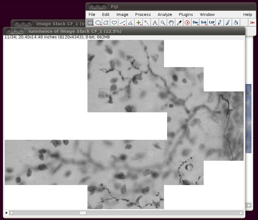 diadem-cerebellar-3