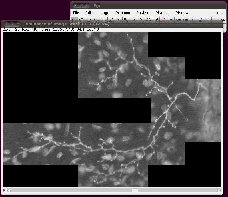 diadem-cerebellar-4