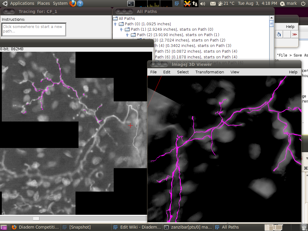 diadem-cerebellar-8