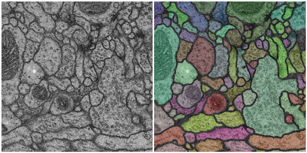 Example of ssTEM image and its corresponding segmentation