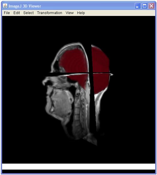 Manwithbrain