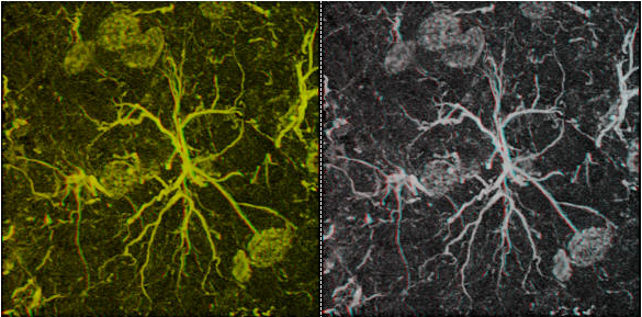 Anaglyph comparisons