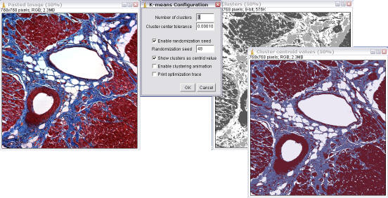 Automatic thresholding 5.1.1.2