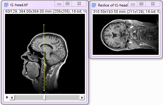 Stack reslice example