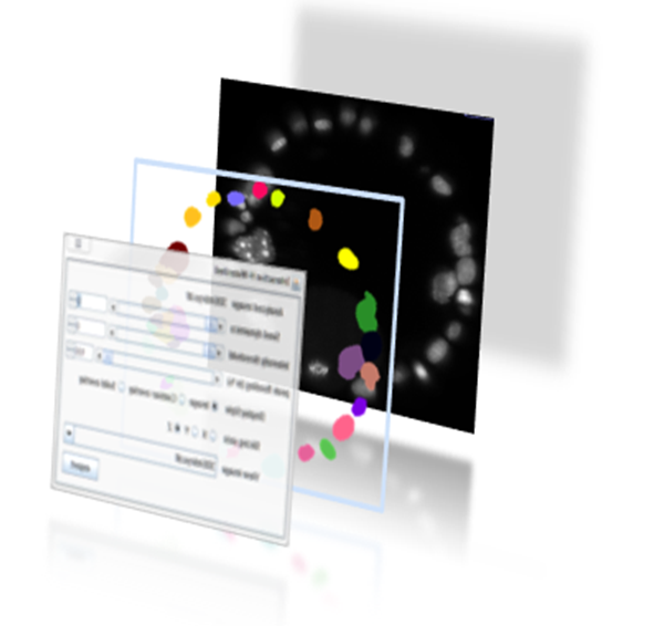 Interactive Watershed plugin showing control panel and segmentation overlay