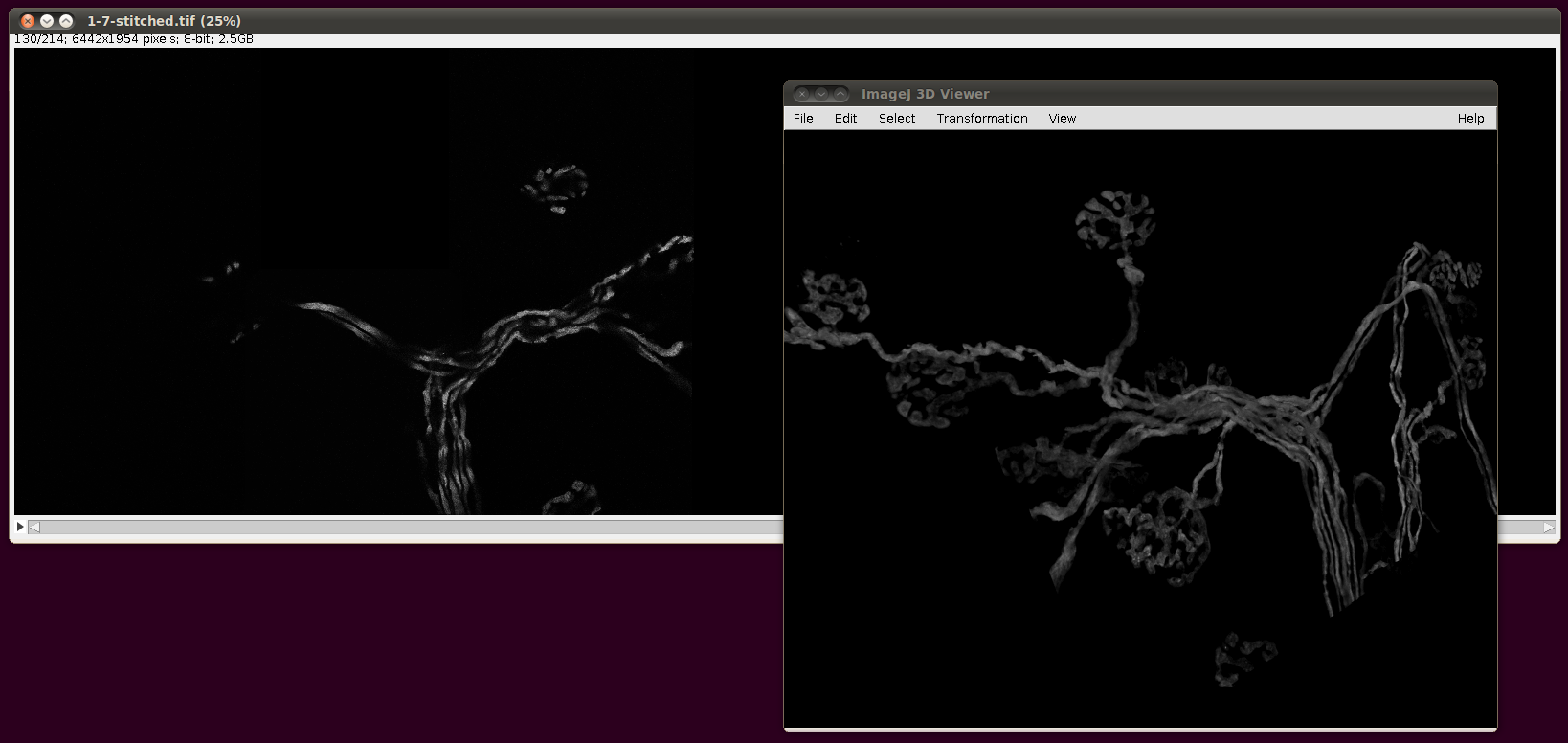 neuromuscular-0-7-stitched