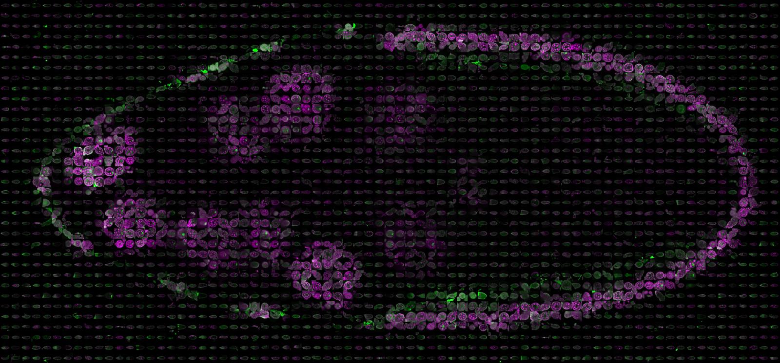 Stage 10 Drosophila egg chamber