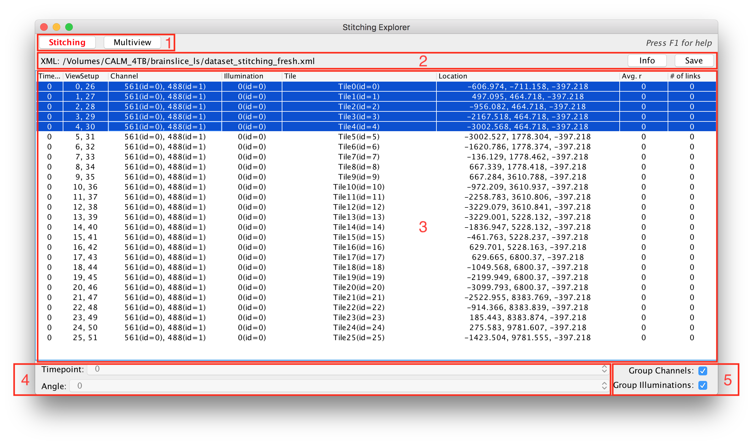 BigStitcher Overview 1