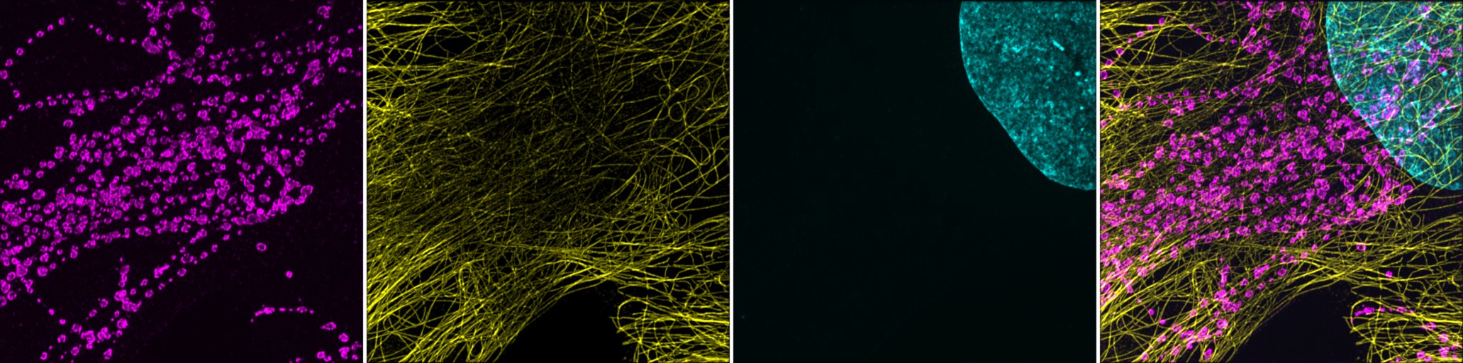 fig:3 channels image, in Cyan Magenta and Yellow 3 channels image, in Cyan Magenta and Yellow