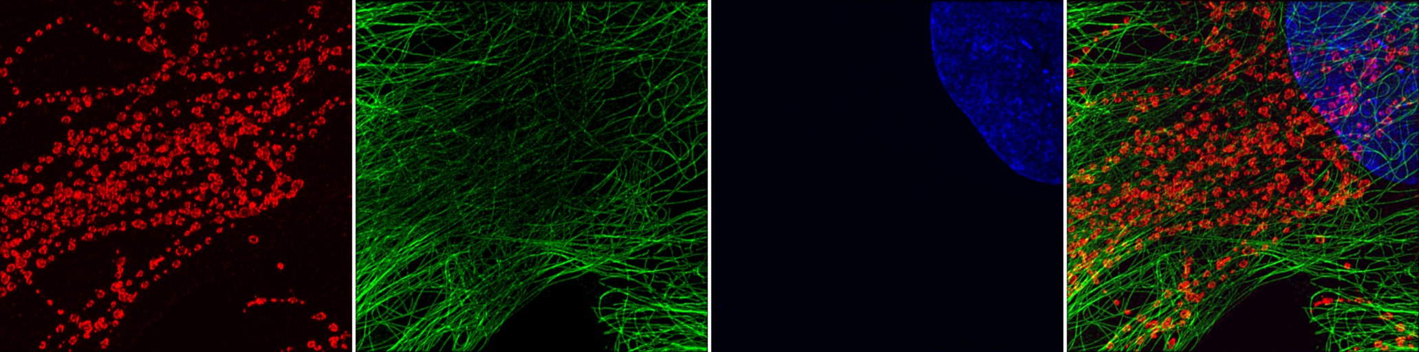 fig:3 channels image, in Red Green Blue and Merge 3 channels image, in Red Green Blue and Merge