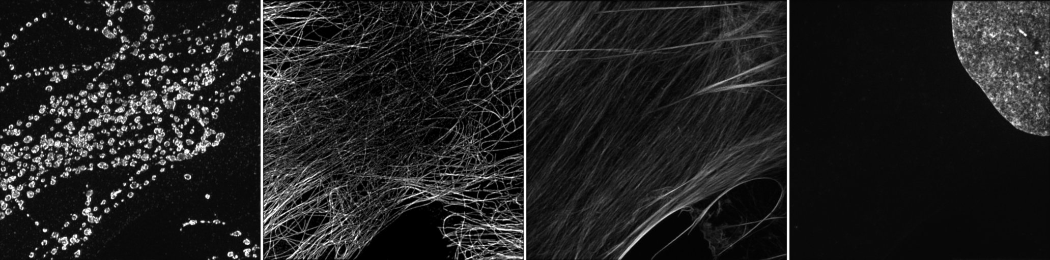 fig:4 channels image, each in Grays levels 4 channels image, each in Grays levels