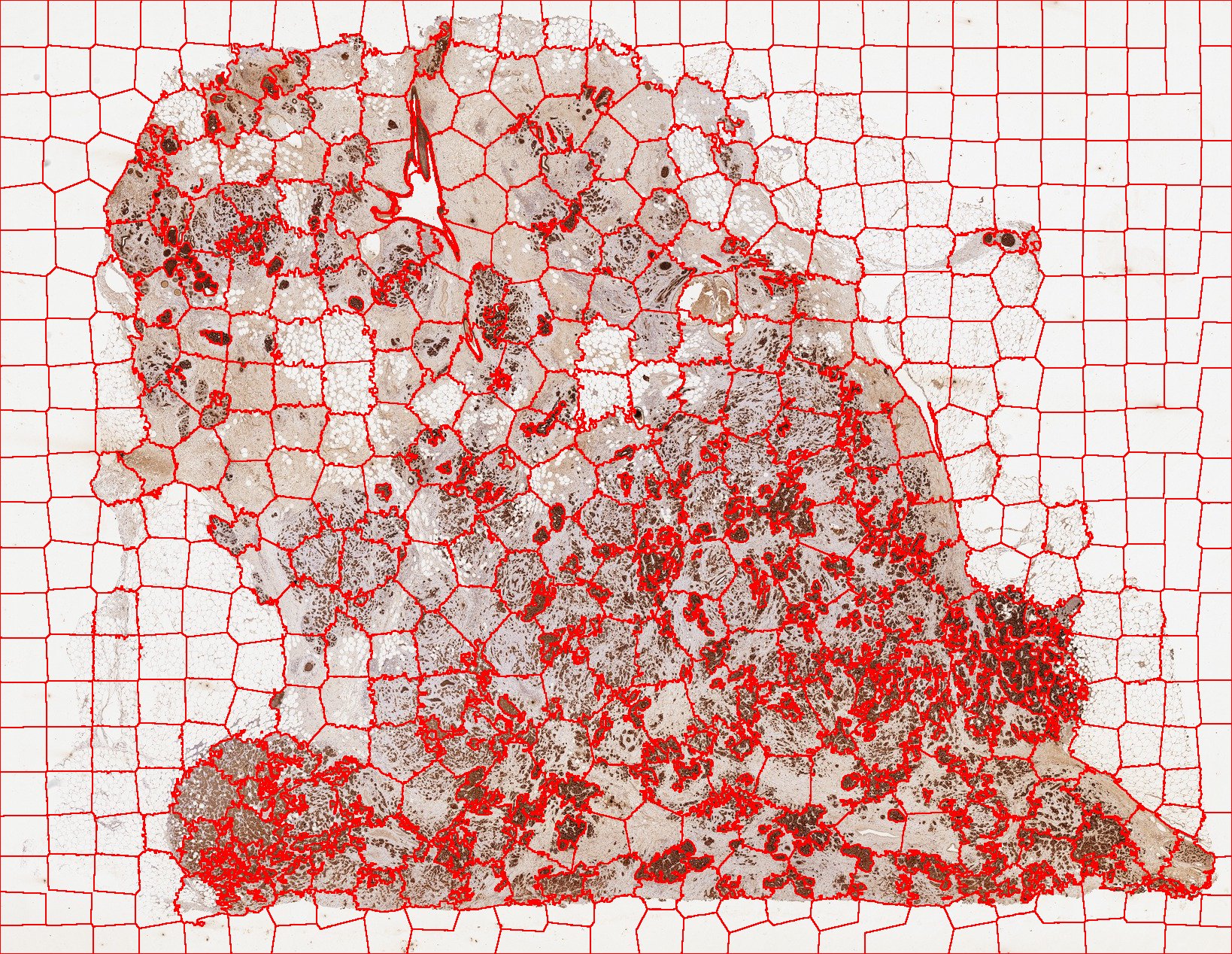 human-breast-cytokeratin-jslic