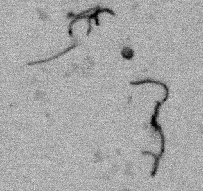 Cnt ridge detection original