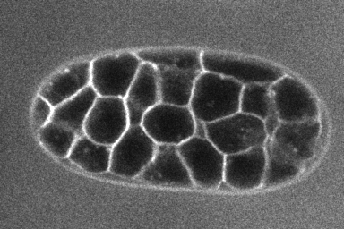 C. Elegans embryo membrane labeling example image
