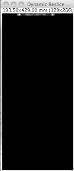 Dynamicreslice