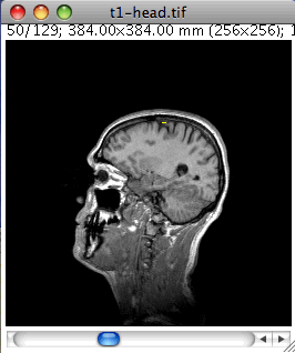 Dynamicresliceroi