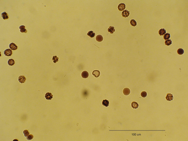 Embryos original sample