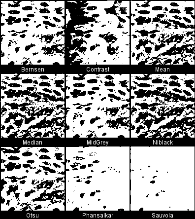 Epithm2