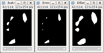 Erodedilate