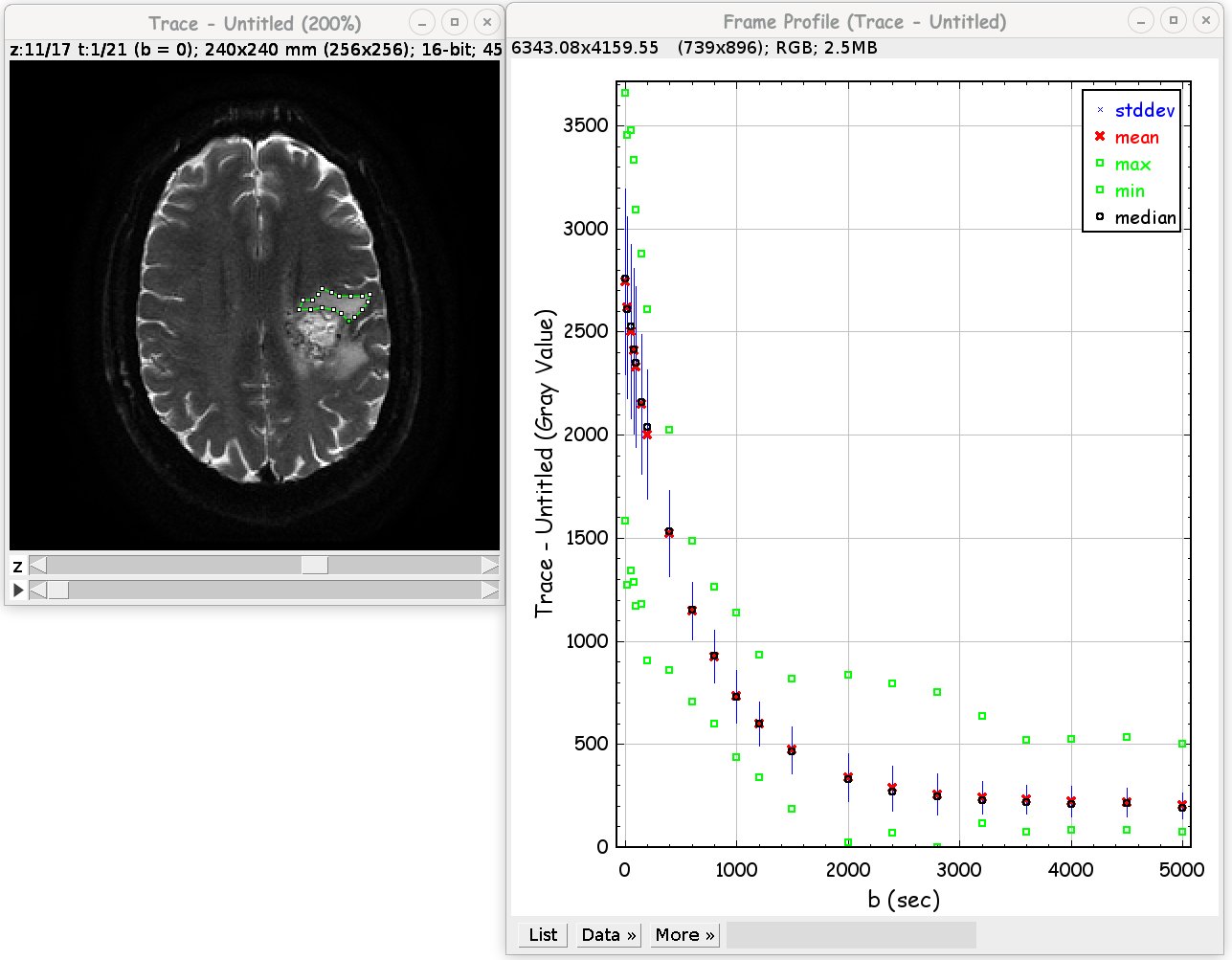 F profiler screenshot
