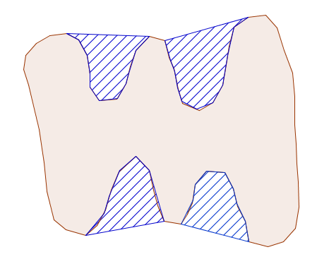 Local concavity region detection (Farhan)