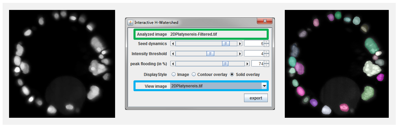 Interactive Watershed with custom background image for quality assessment