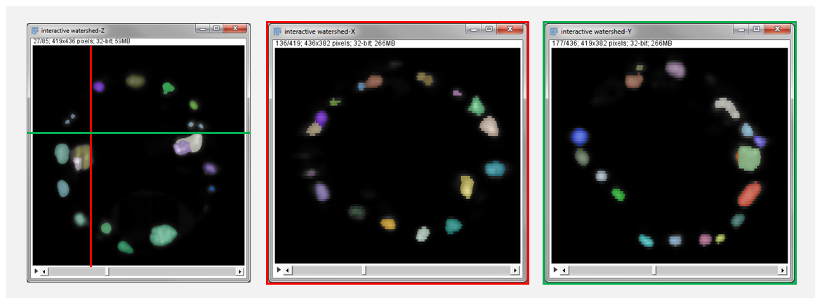 Interactive Watershed 3D side views in XY, YZ and XZ orientations
