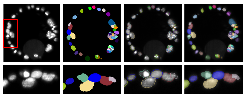 Interactive Watershed segmentation display modes comparison