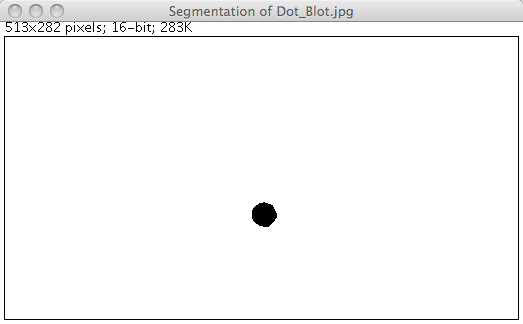 Fast Marching segmentation result