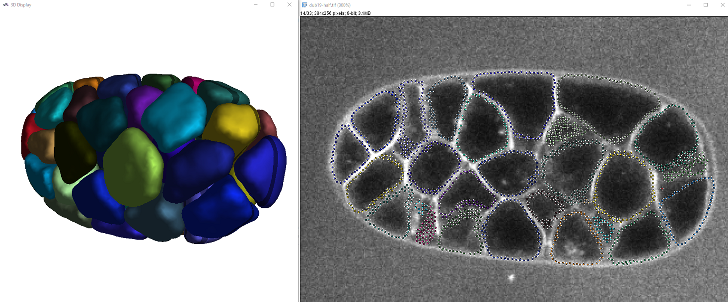 LimeSeg C. Elegans full embryo segmentation at one timepoint