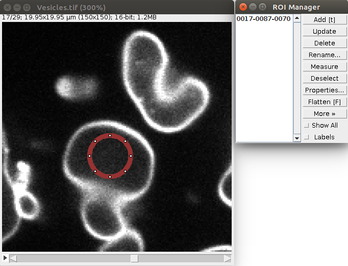Circular ROI seed drawn within vesicle for LimeSeg