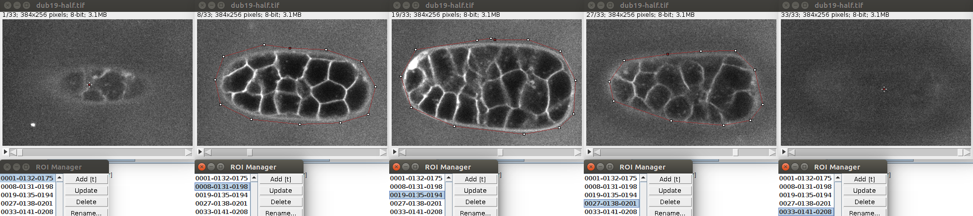 LimeSeg ROI skeleton defining C. Elegans embryo contour