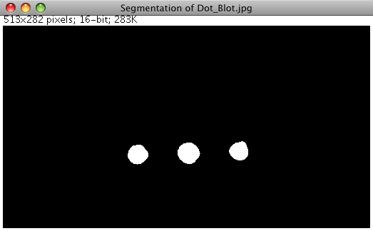 Level Sets segmentation result with all three dots segmented