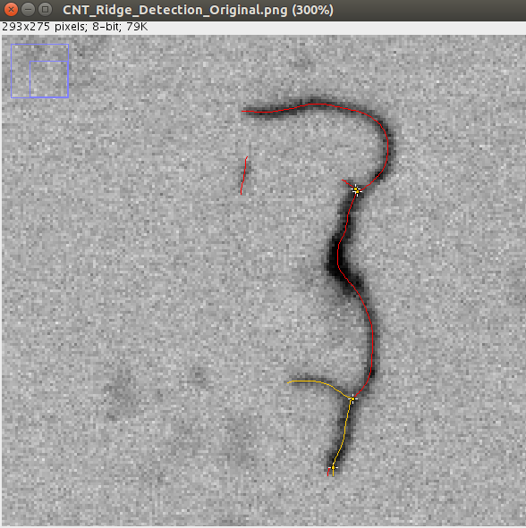 Poor overlap detection due to superfluous junction point