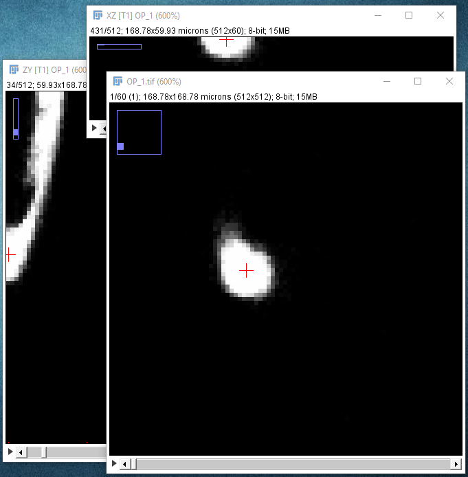 SNT zooming in on neurite to adjust snapping neighborhood
