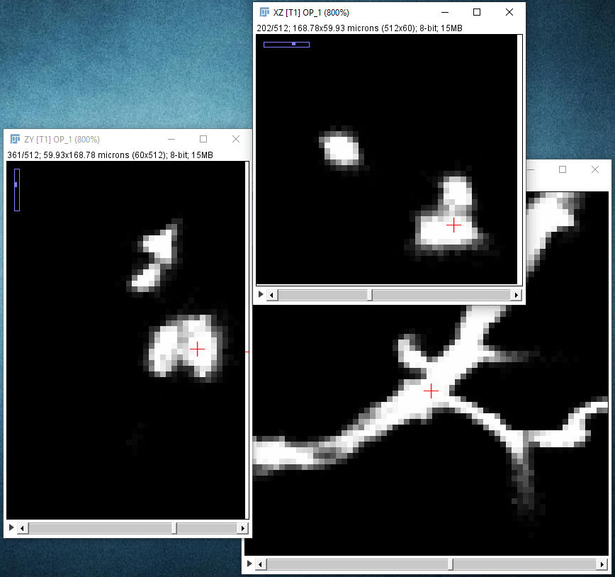 SNT zooming in on next path point for precise placement