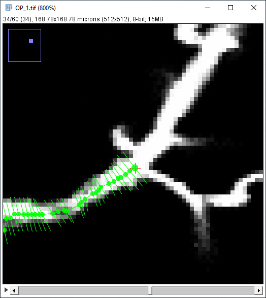 SNT path fitted to midline with sub-voxel accuracy