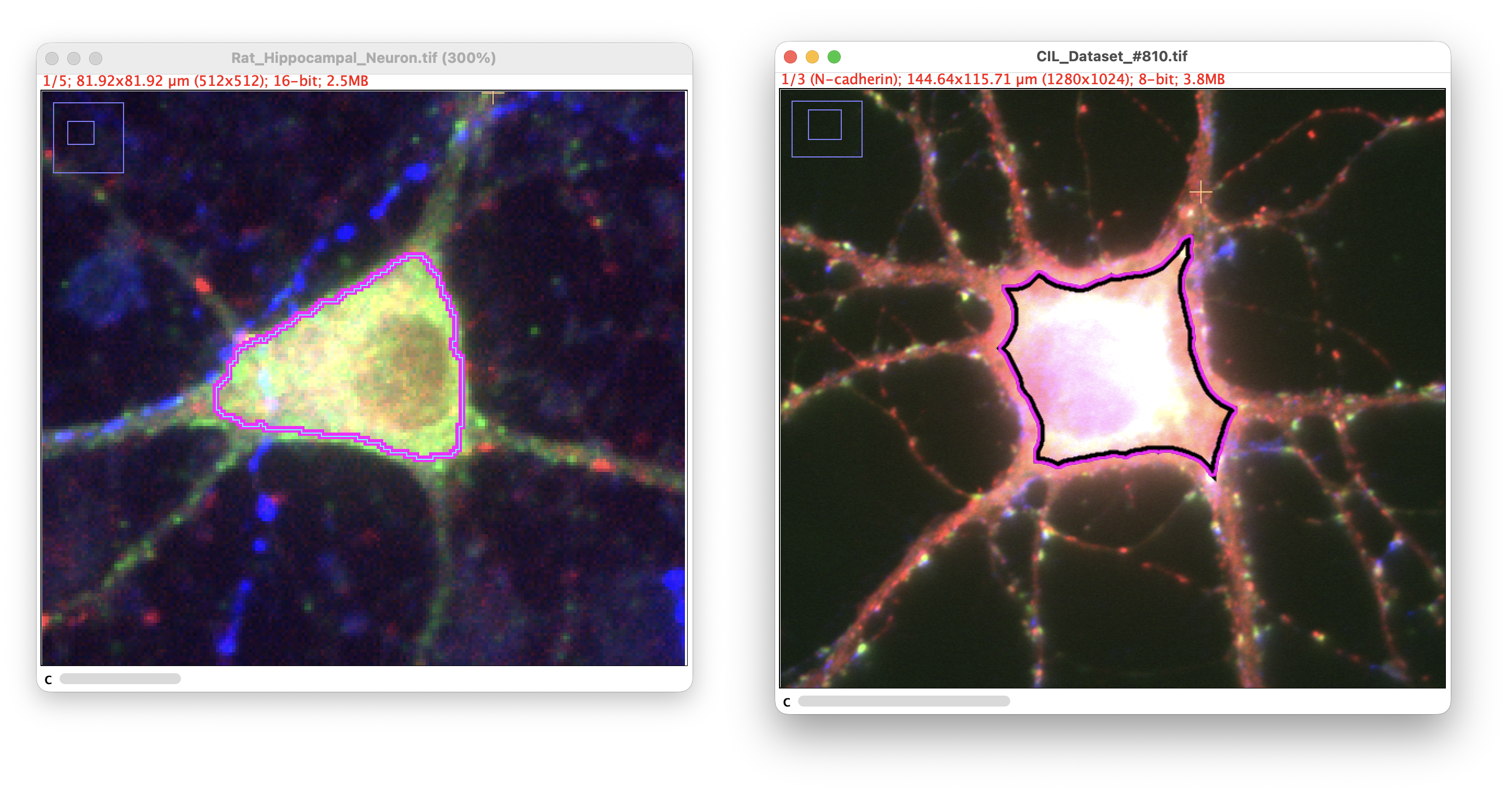 /media/plugins/snt/snt-soma-detection.png