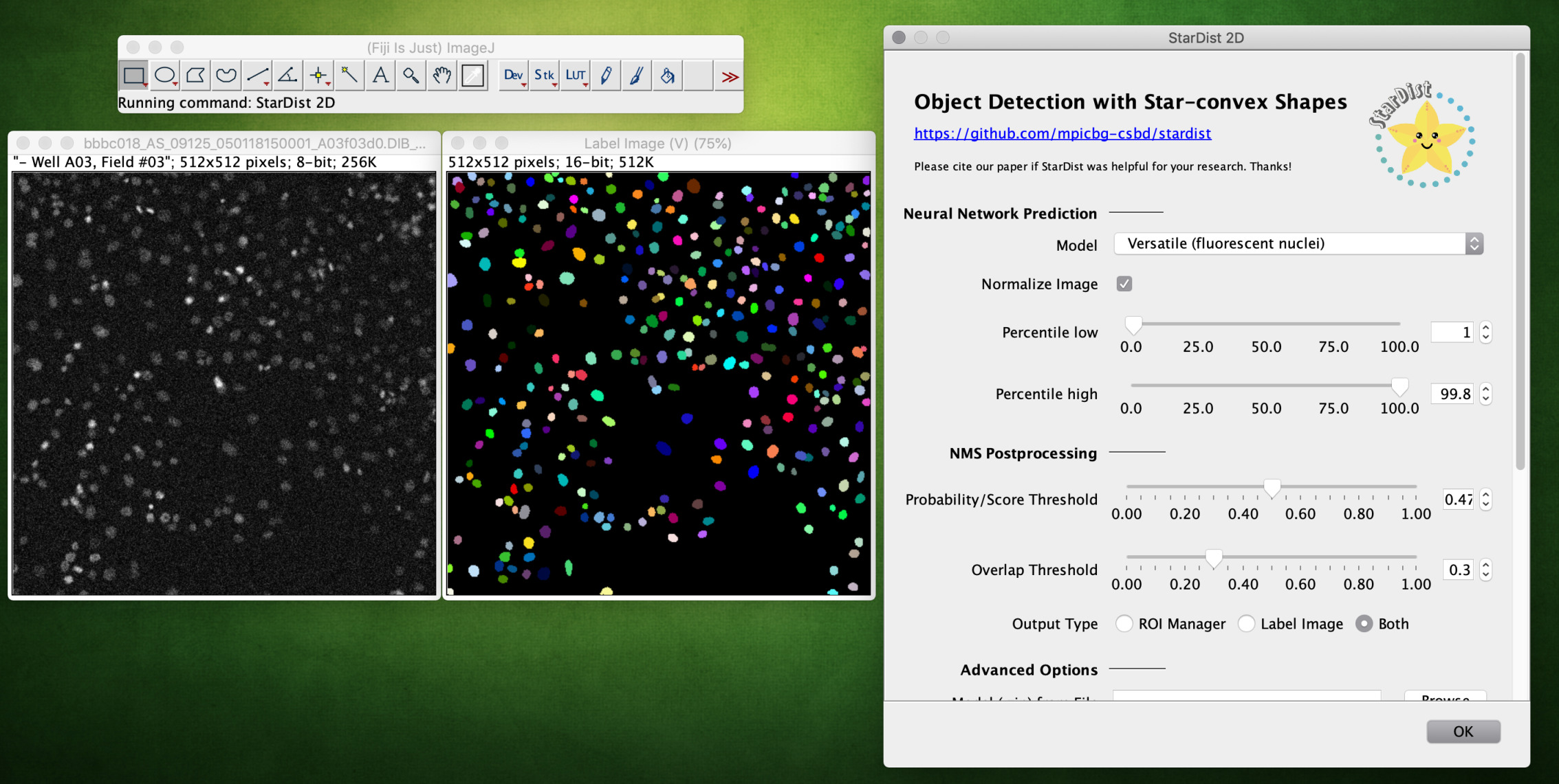StarDist plugin screenshot