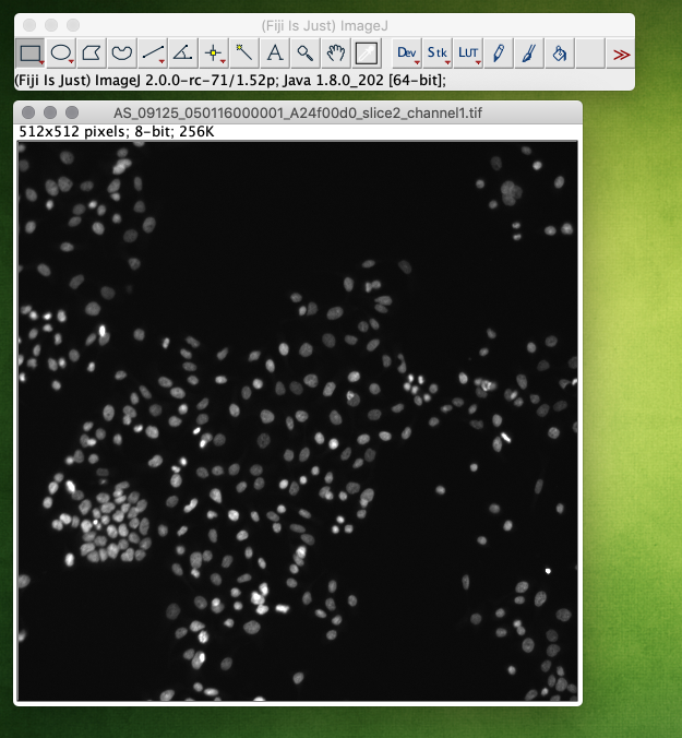 StarDist input image for segmentation