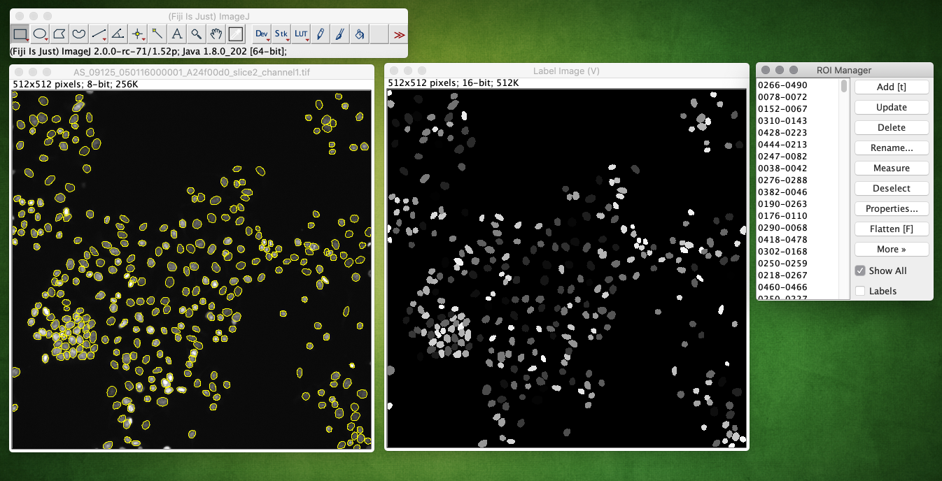 StarDist segmentation output with label image and ROIs