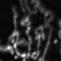 Figure 1: TMRM stained mitochondria before analysis (resized from original).