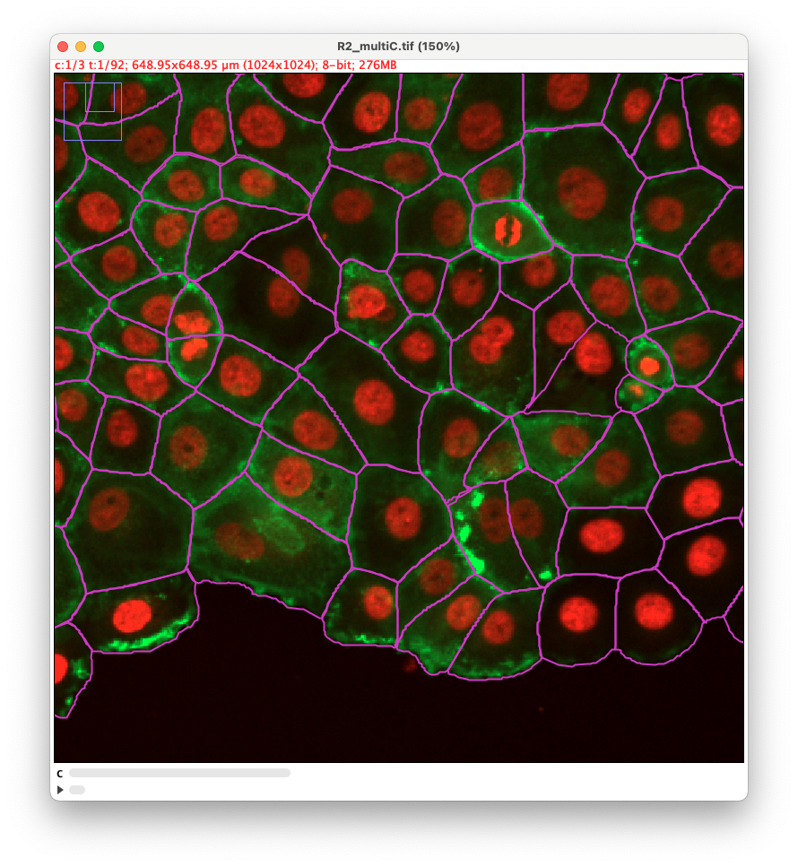 /media/plugins/trackmate/detectors/cellpose/trackmate-cellpose-sam-allchannels.png