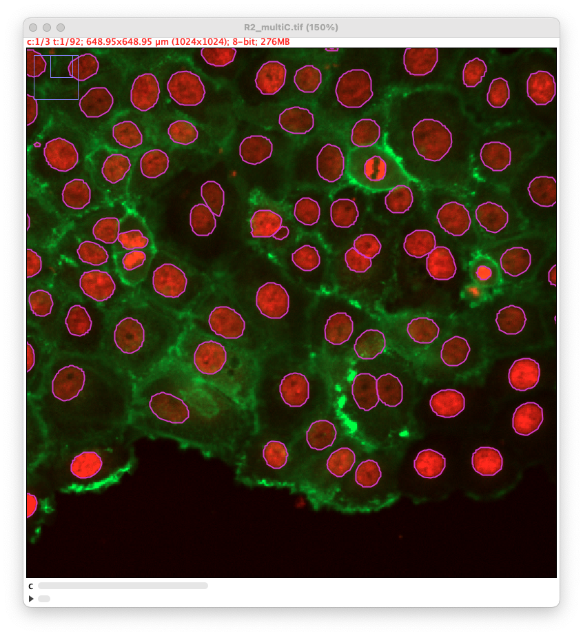 /media/plugins/trackmate/detectors/cellpose/trackmate-cellpose-sam-channel-1.png