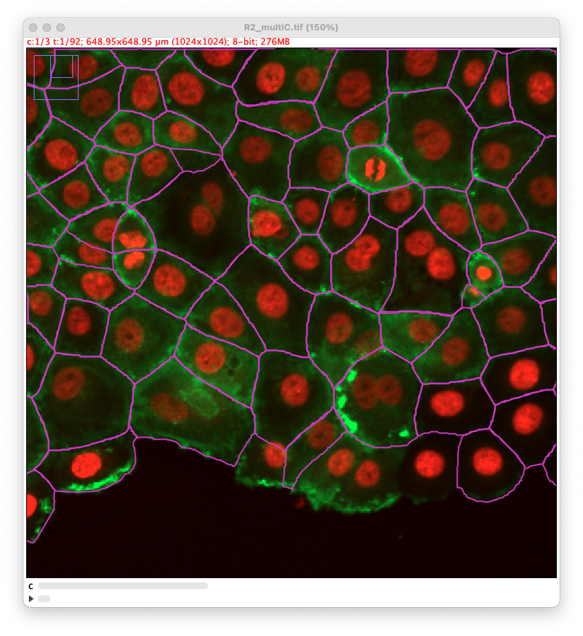 /media/plugins/trackmate/detectors/cellpose/trackmate-cellpose-sam-channel-2.png
