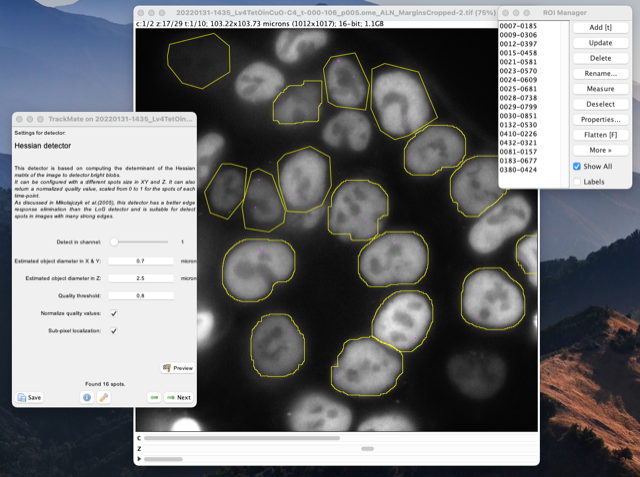 /media/plugins/trackmate/detectors/trackmate-hessian-detector-07.png